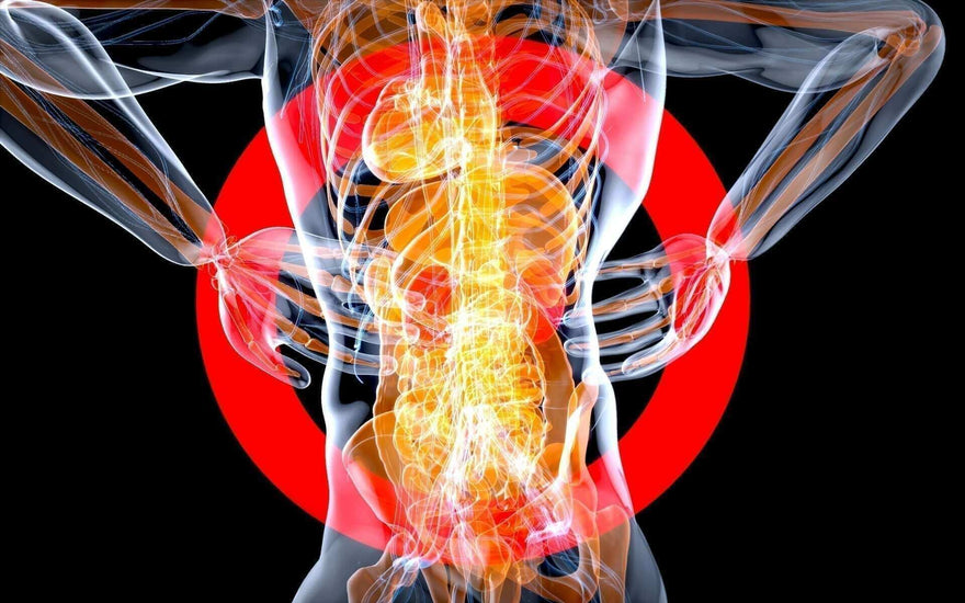 How to Alleviate Sciatica Nerve Pain: 7 Effective Solutions